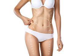 Tailoring Your Tummy Tuck: Custom Procedures in Miami